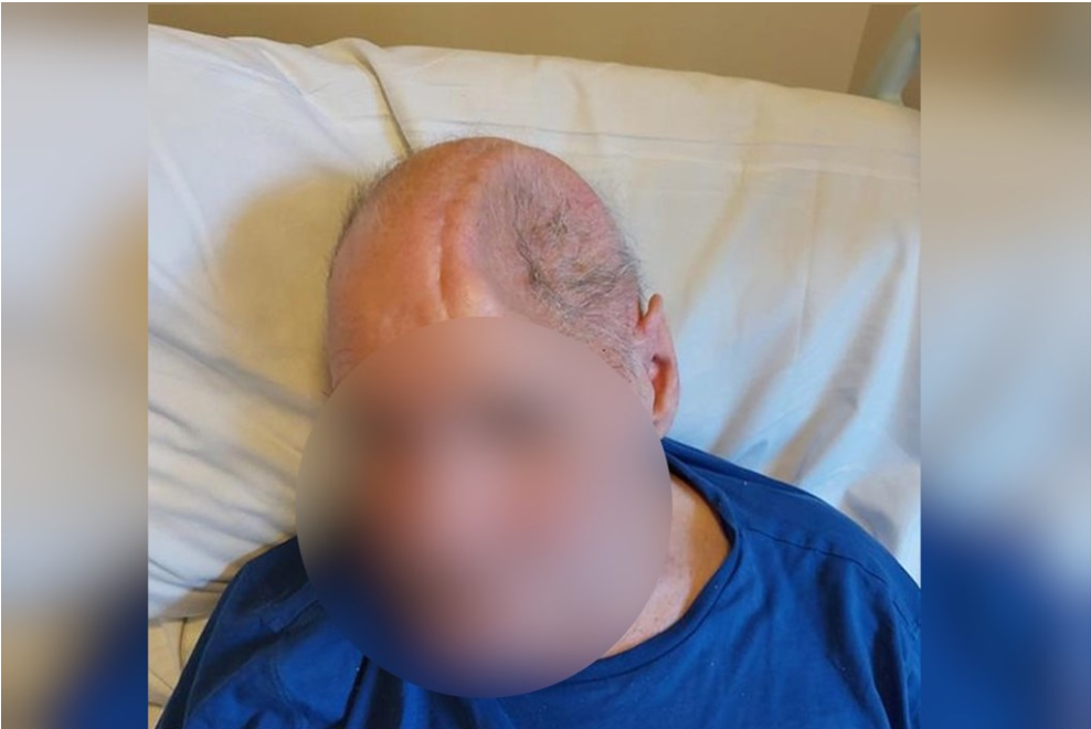 Cyclist sustained serious head injury after collision